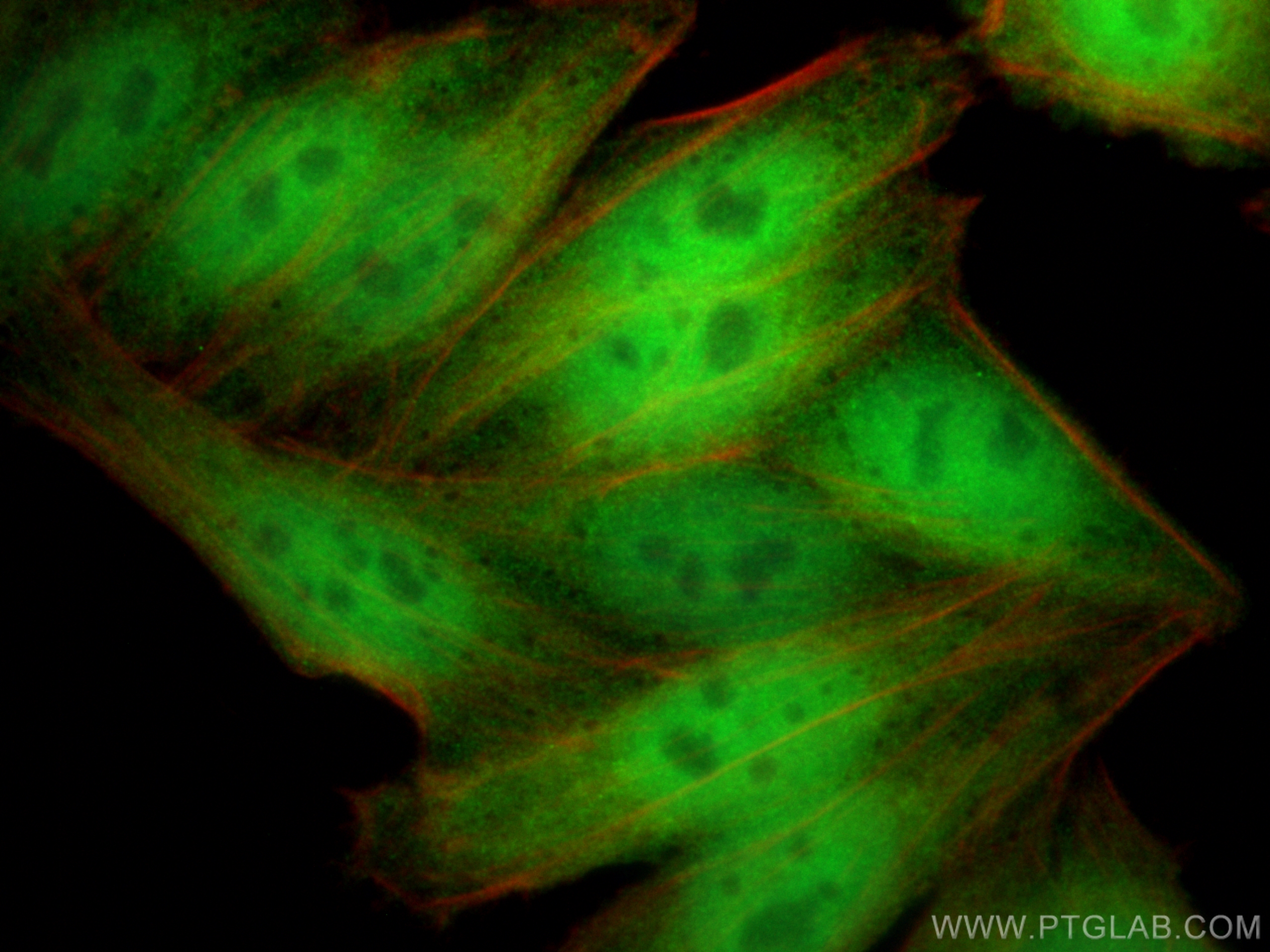 IF Staining of HepG2 using 66900-1-Ig