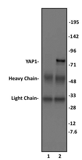 YAP1 antibody (pAb) tested by Immunoprecipitation. 10 ul of YAP1 antibody was used to immunoprecipitate YAP1 from 400 ug of HeLa whole cell extract (lane 2). 10 ul of rabbit IgG was used as a negative control (lane 1). The immunoprecipitated protein was detected by Western blotting using the YAP1 antibody at a dilution of 1:500.