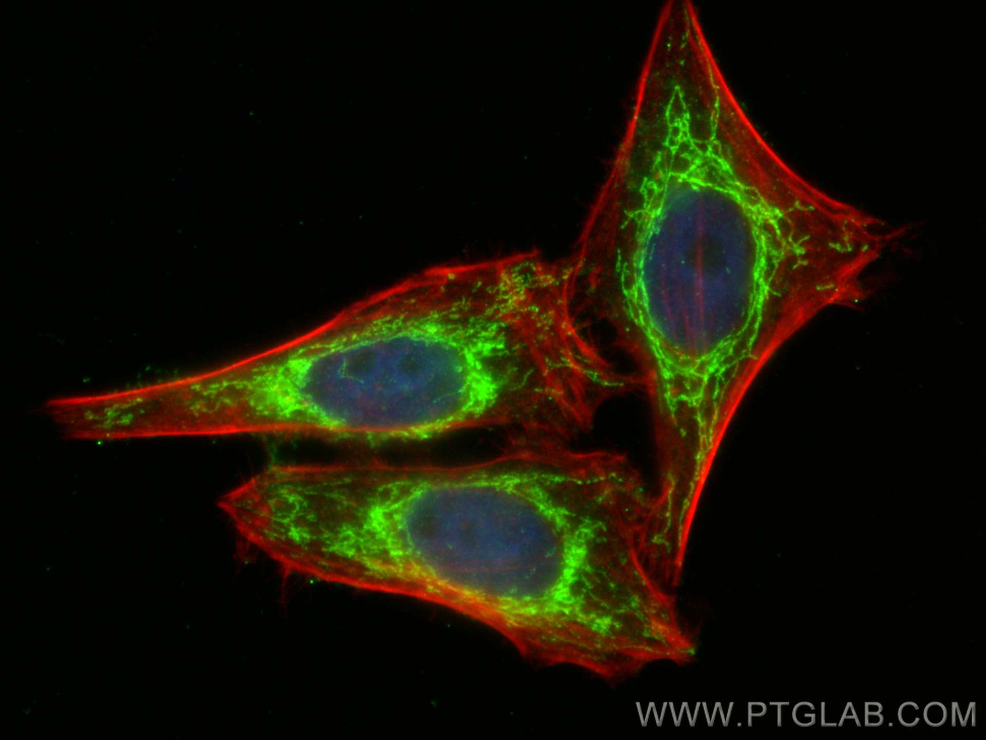 IF Staining of HepG2 using 17150-1-AP