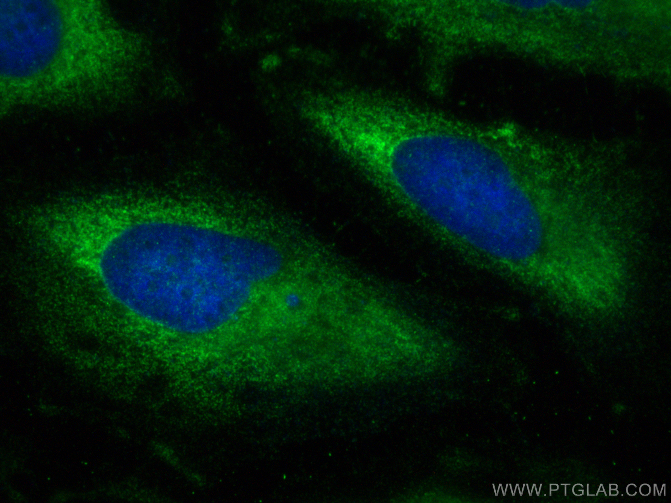 IF Staining of HeLa using 20339-1-AP