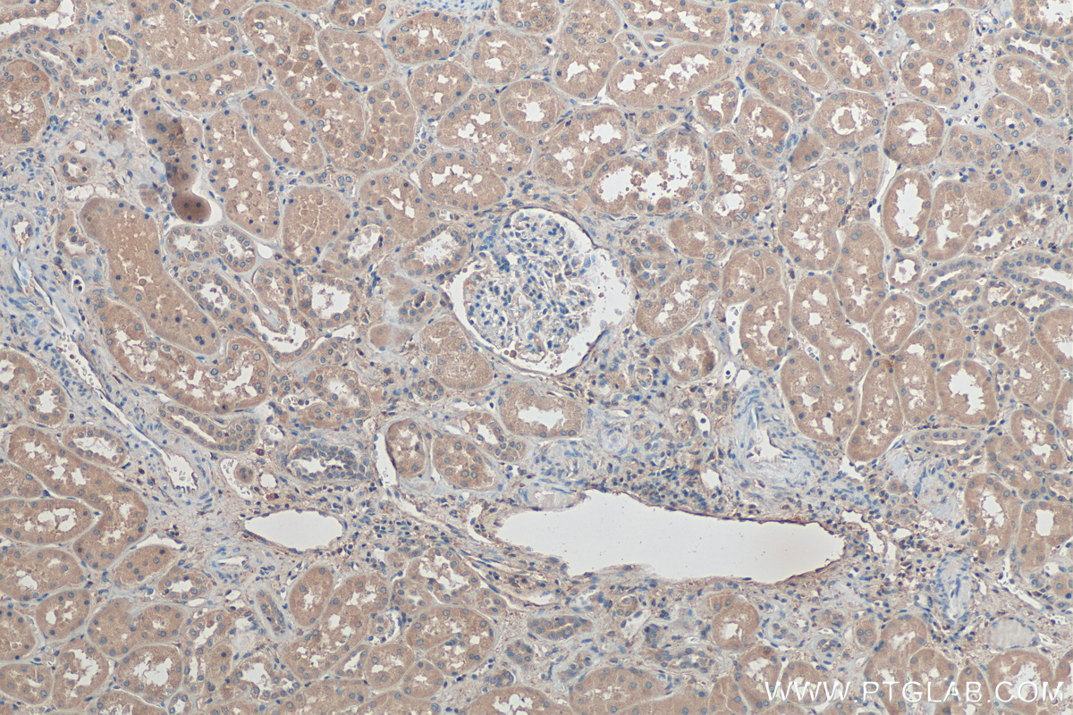 IHC staining of human kidney using 67196-1-Ig (same clone as 67196-1-PBS)