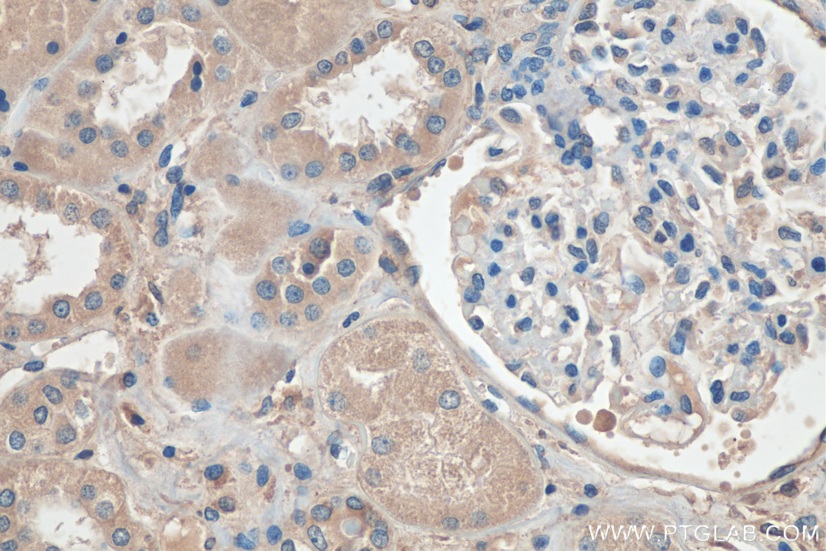 IHC staining of human kidney using 67196-1-Ig (same clone as 67196-1-PBS)