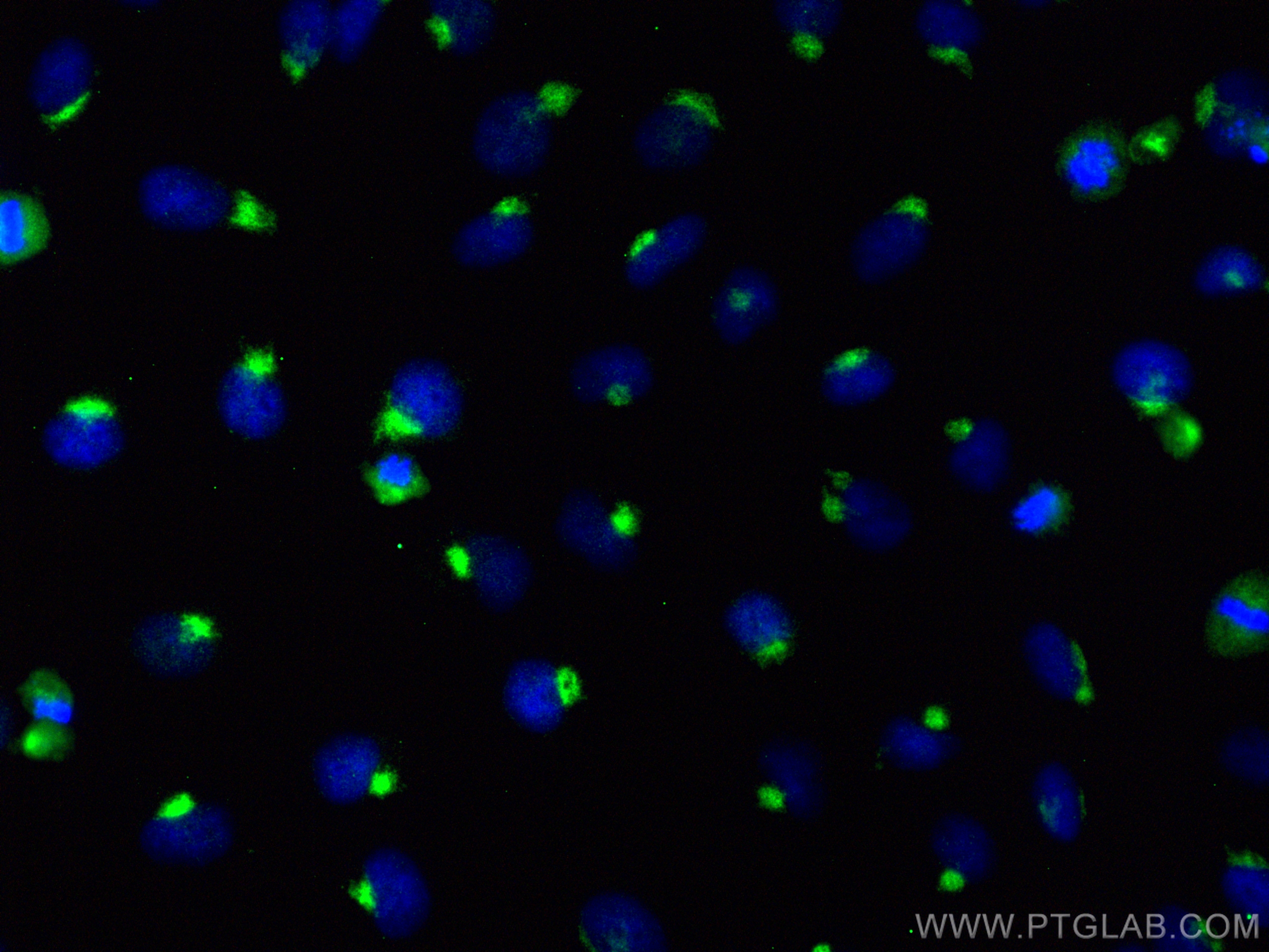 IF Staining of HeLa using 15473-1-AP