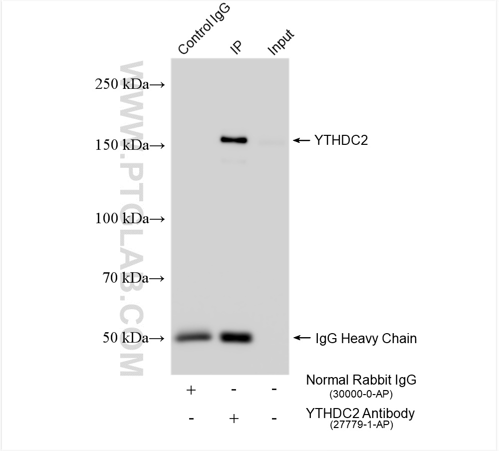 IP experiment of HeLa using 27779-1-AP