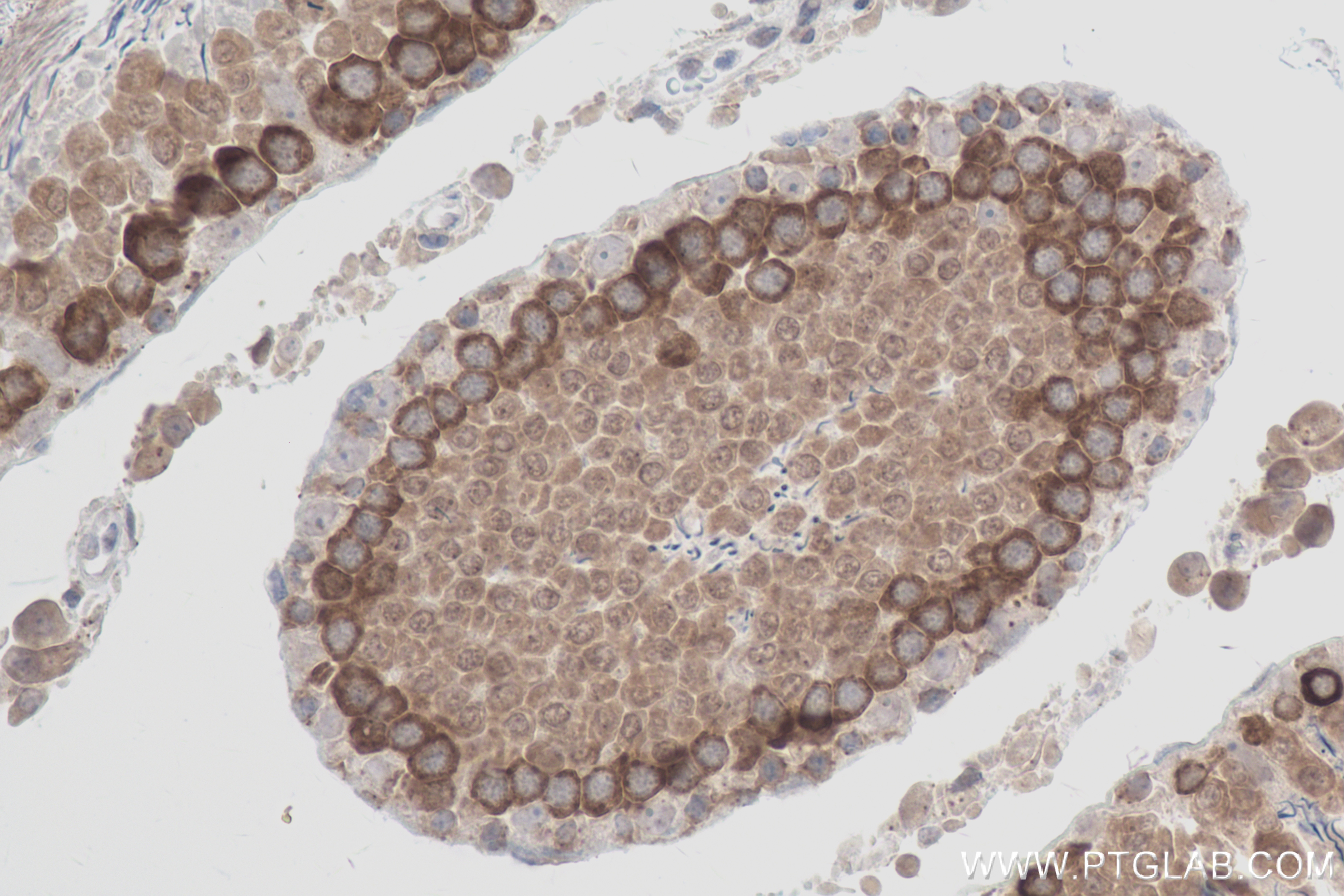 IHC staining of rat testis using 83970-1-RR (same clone as 83970-1-PBS)