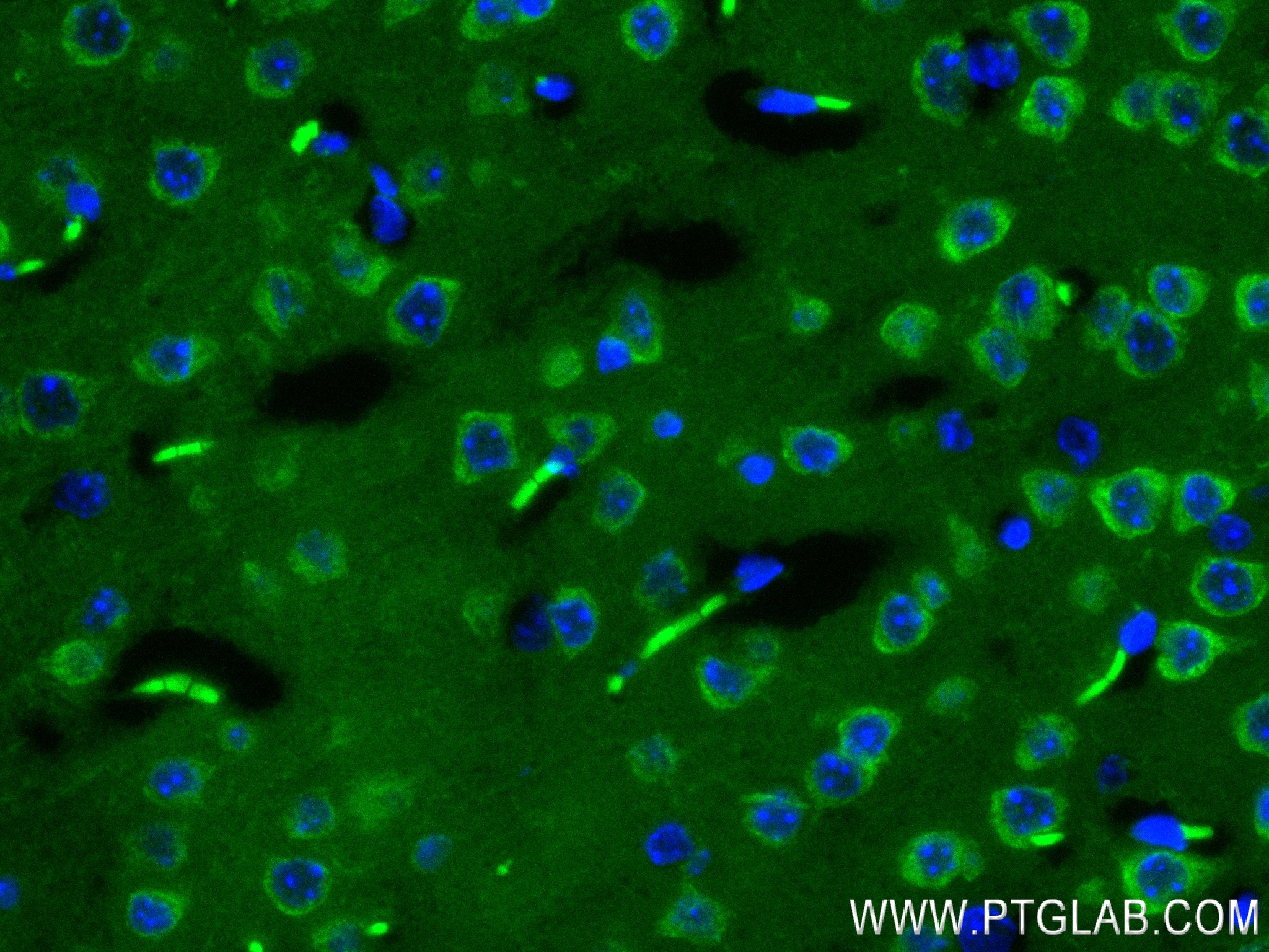 IF Staining of mouse brain using 80876-2-RR