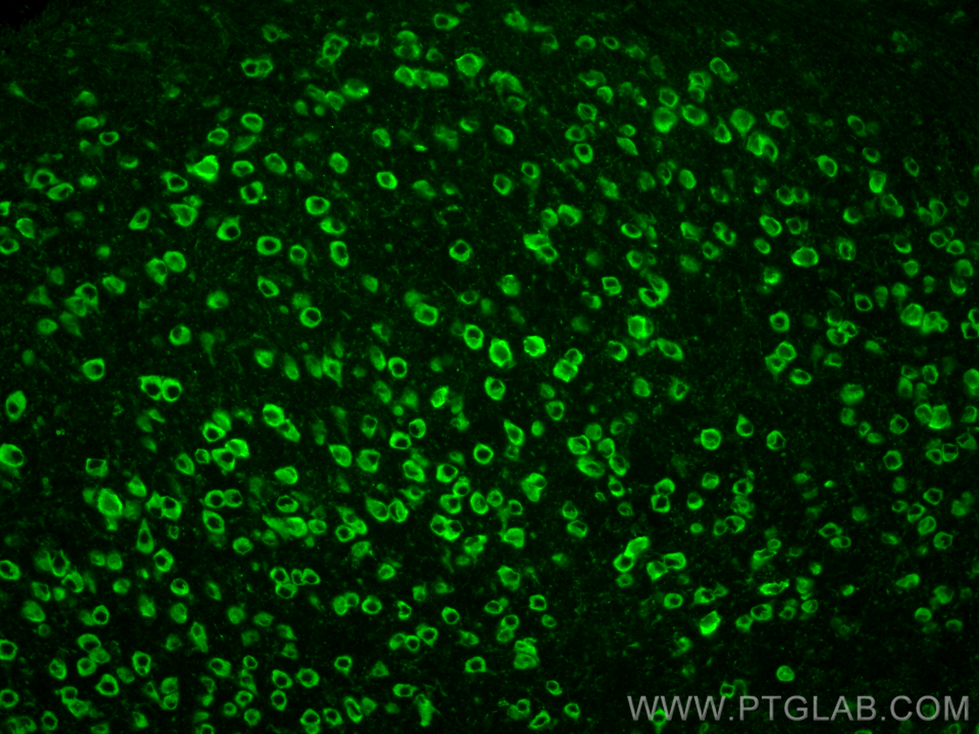 IF Staining of mouse brain using 24744-1-AP