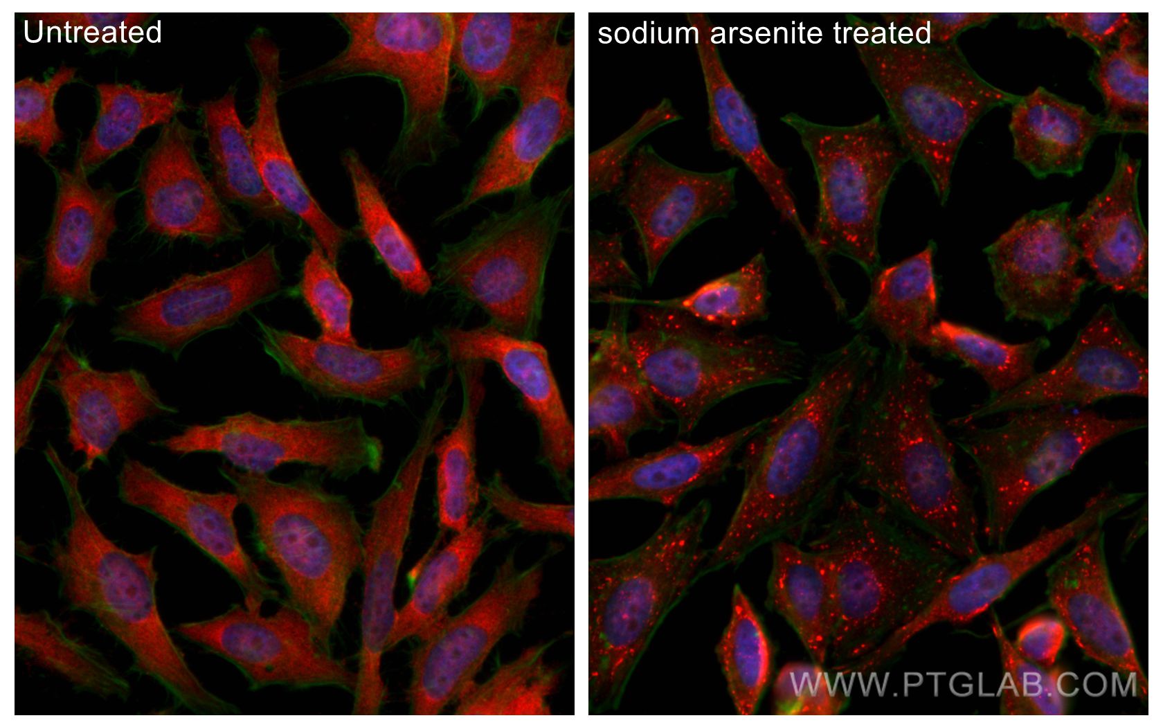 IF Staining of HeLa using 24744-1-AP