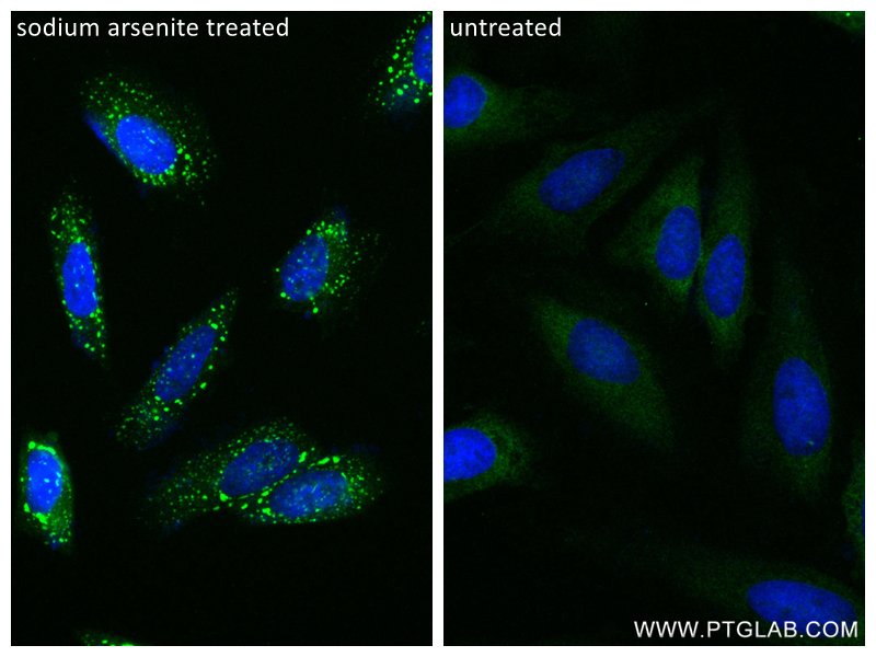 IF Staining of HeLa using 81340-1-RR (same clone as 81340-1-PBS)