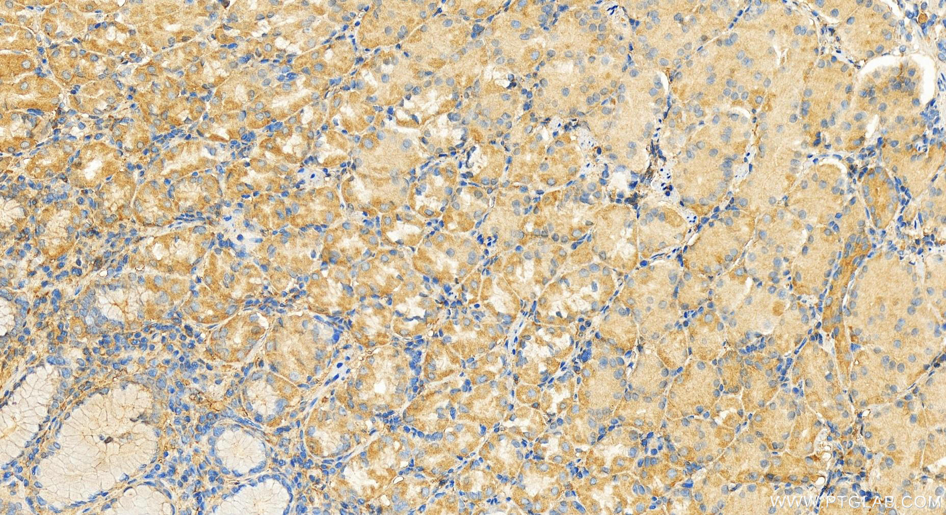 IHC staining of human stomach using 15222-1-AP