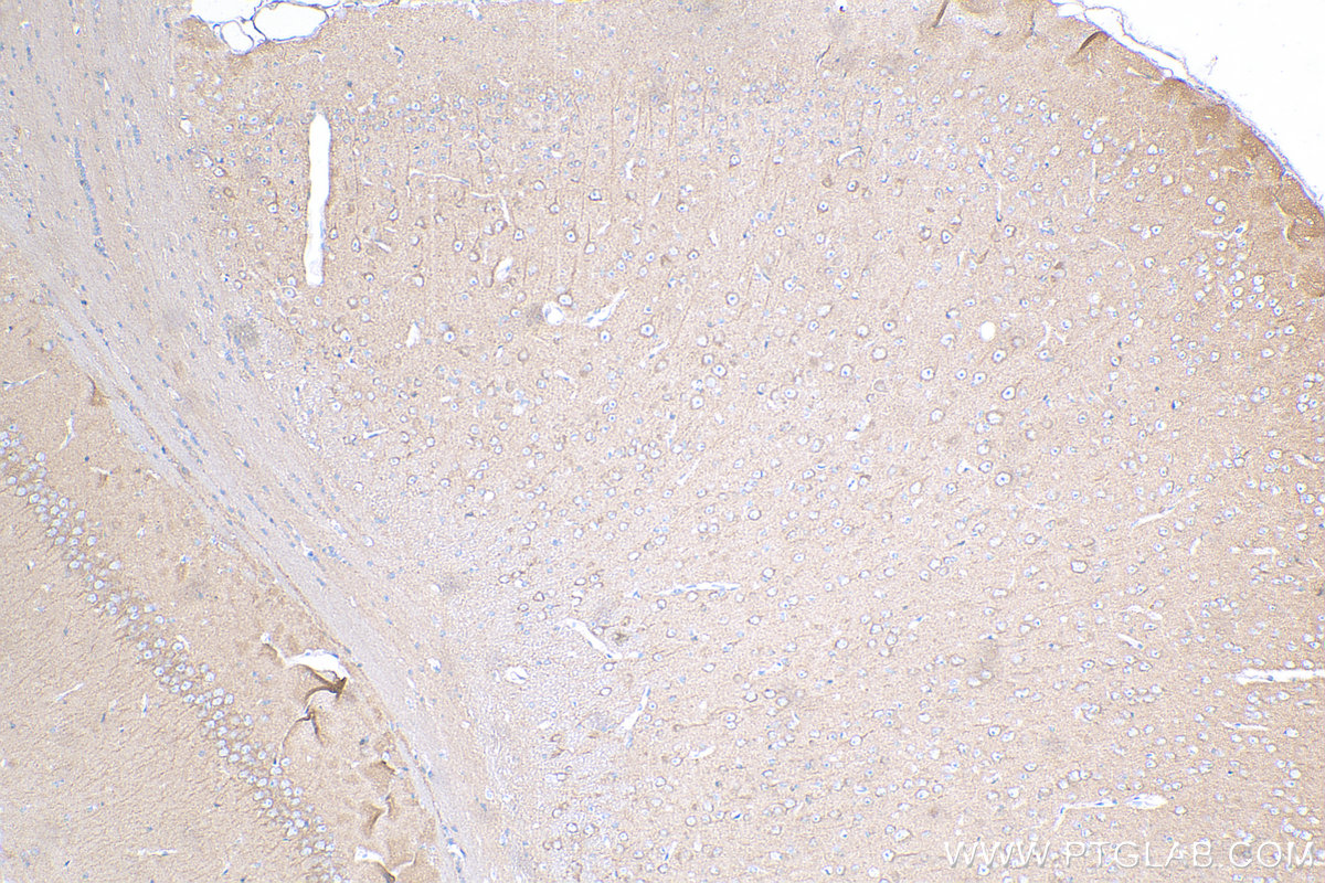 IHC staining of mouse brain using 15222-1-AP