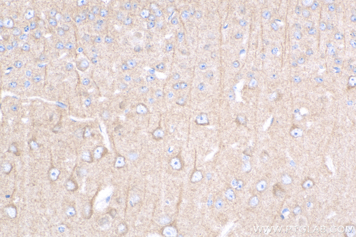 IHC staining of mouse brain using 15222-1-AP