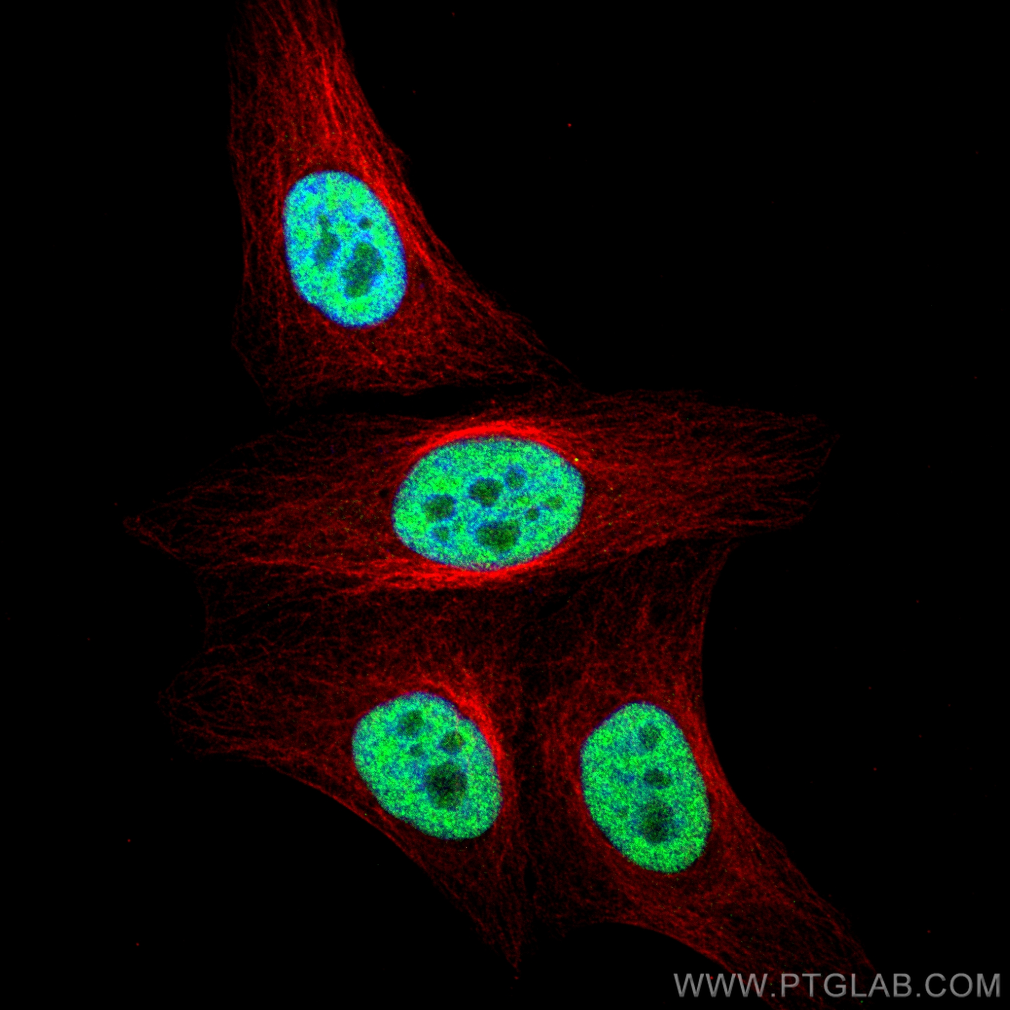 IF Staining of HepG2 using 22156-1-AP