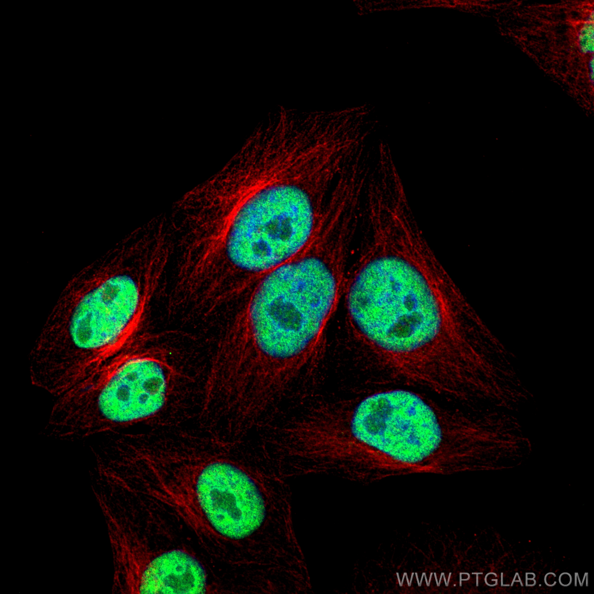 IF Staining of HepG2 using 66281-1-Ig