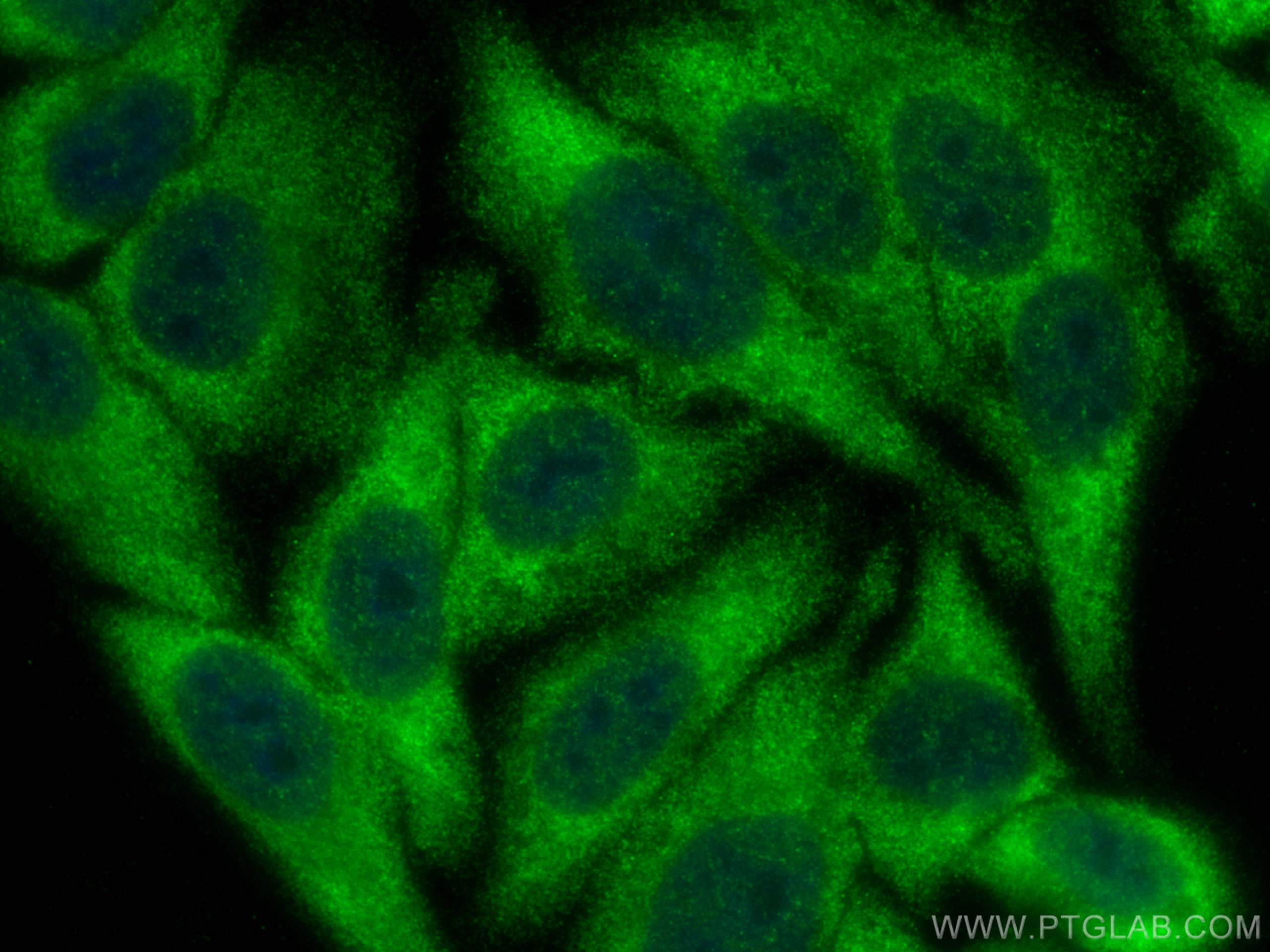 IF Staining of HepG2 using 14945-1-AP