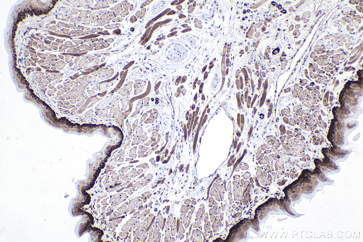 IHC staining of mouse tongue using 28761-1-AP