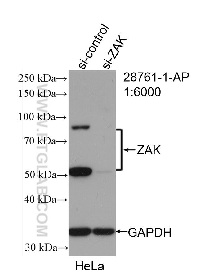 WB analysis of HeLa using 28761-1-AP