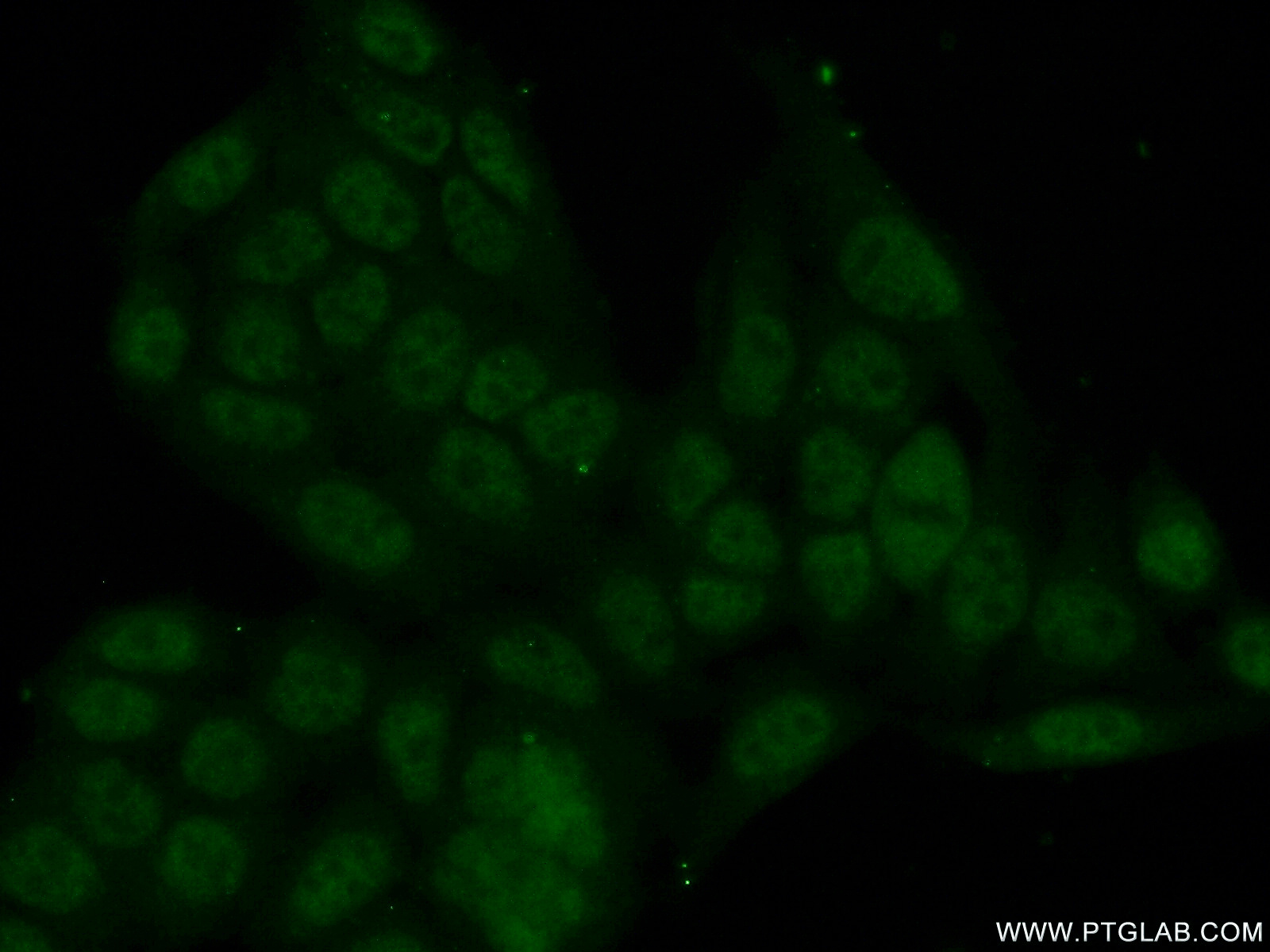 IF Staining of HeLa using 26287-1-AP