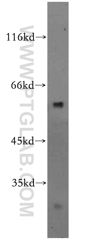 WB analysis of mouse brain using 19817-1-AP