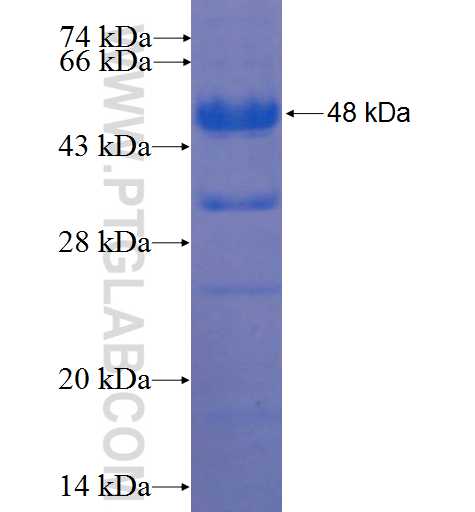 ZBTB44 fusion protein Ag22369 SDS-PAGE