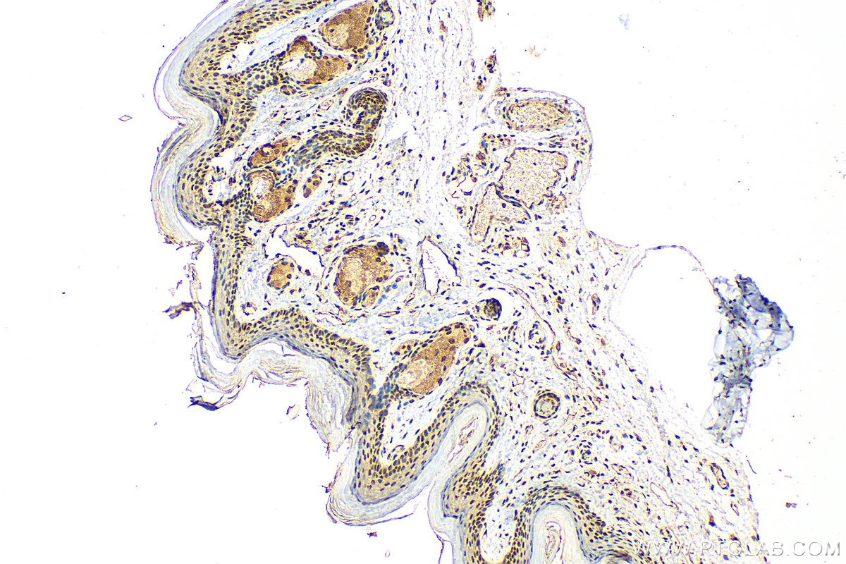 IHC staining of mouse skin using 25455-1-AP