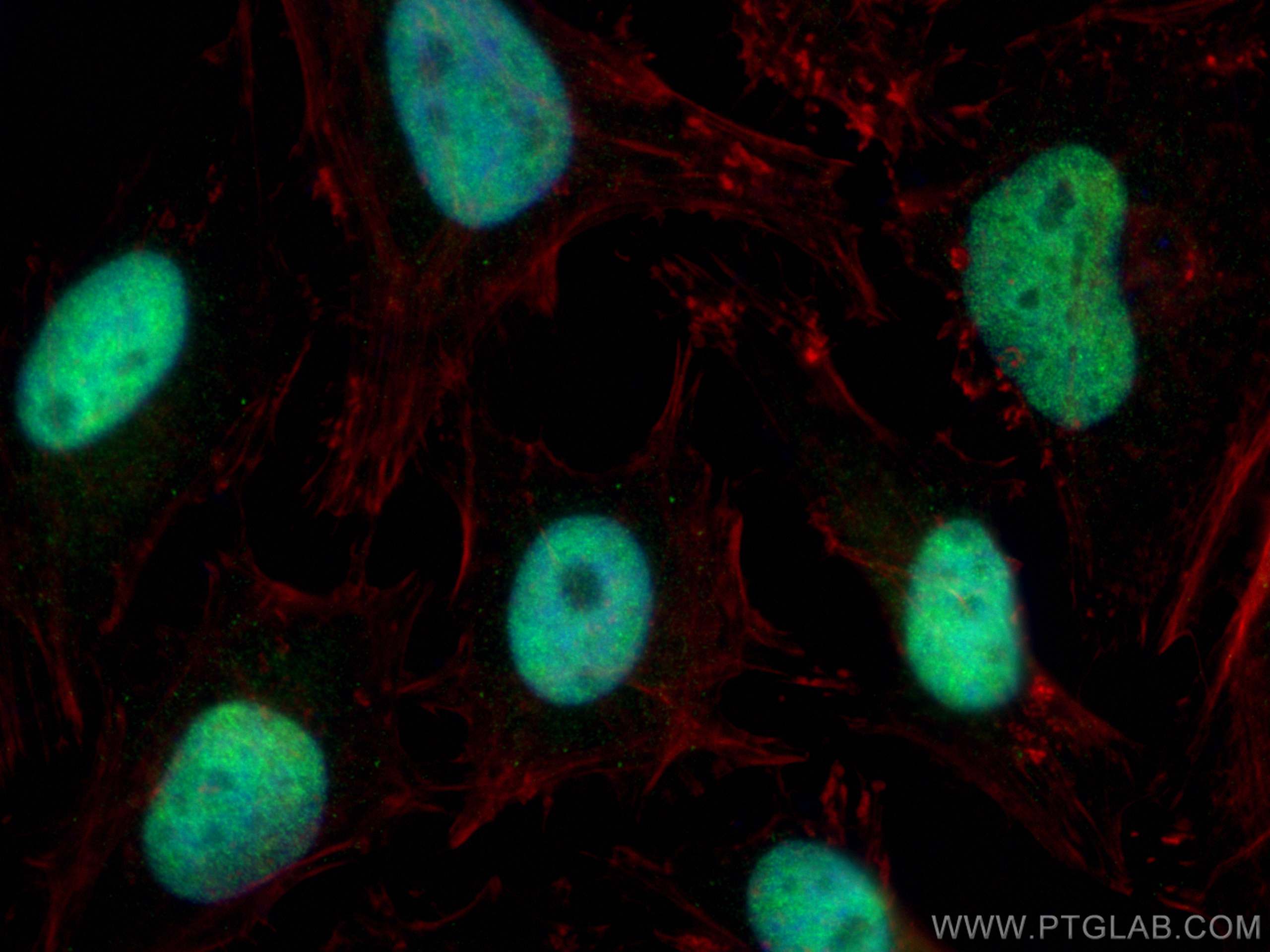 IF Staining of HeLa using 11341-1-AP