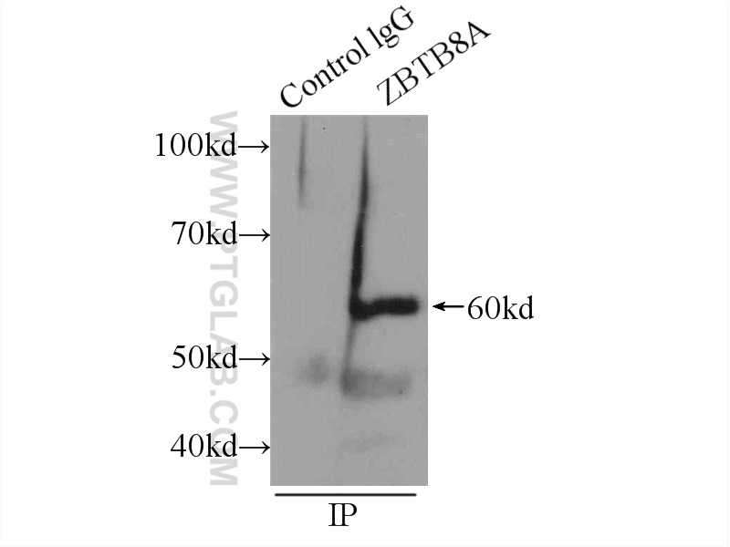 IP experiment of HEK-293 using 24544-1-AP