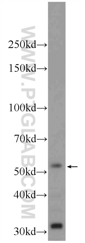 WB analysis of HEK-293 using 24544-1-AP