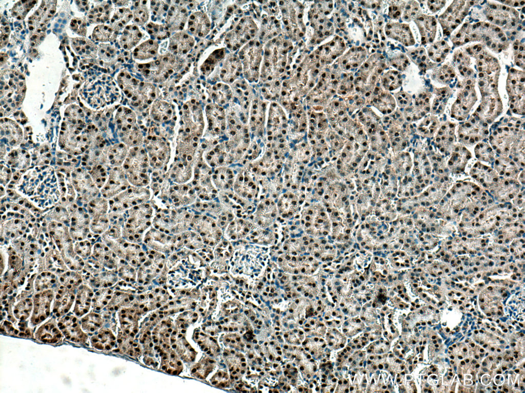 IHC staining of mouse kidney using 28608-1-AP