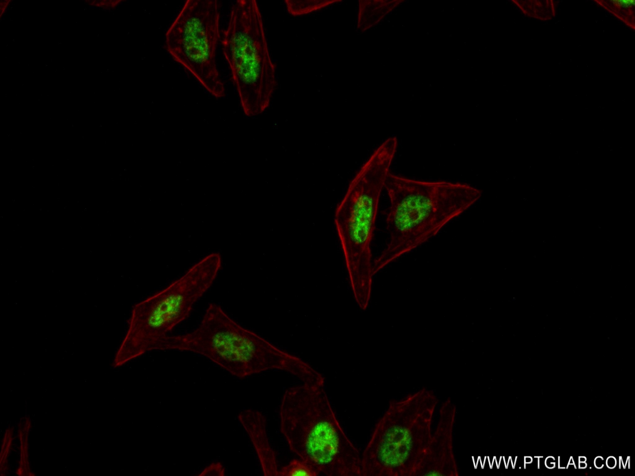 IF Staining of HepG2 using 82912-5-RR (same clone as 82912-5-PBS)