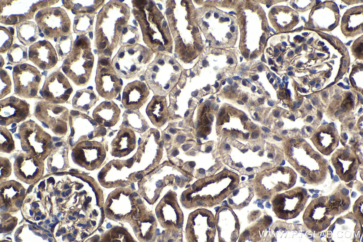 IHC staining of mouse kidney using 25009-1-AP