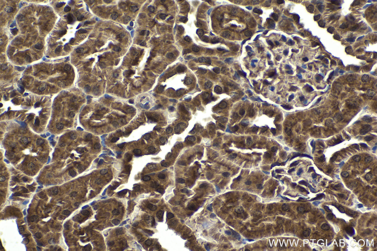 IHC staining of rat kidney using 25009-1-AP