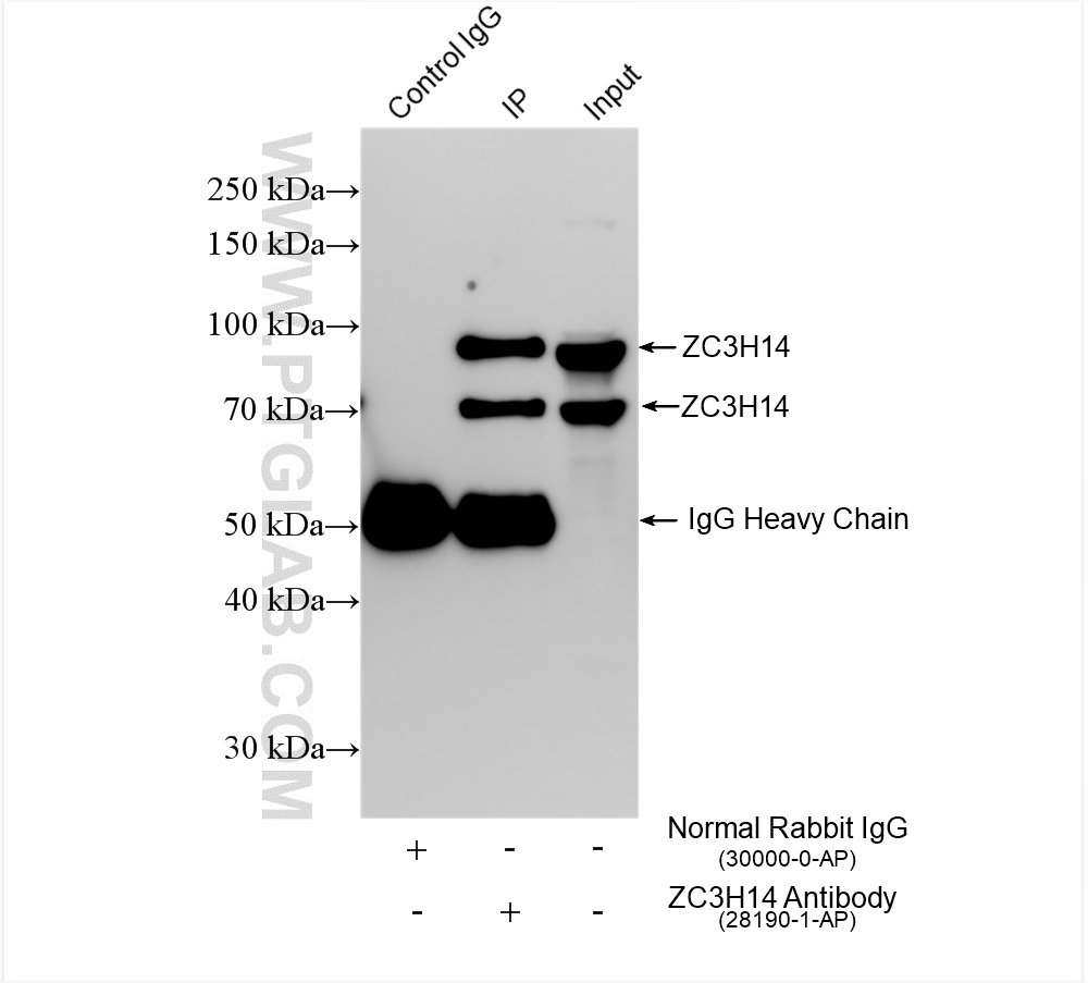 IP experiment of HEK-293T using 28190-1-AP