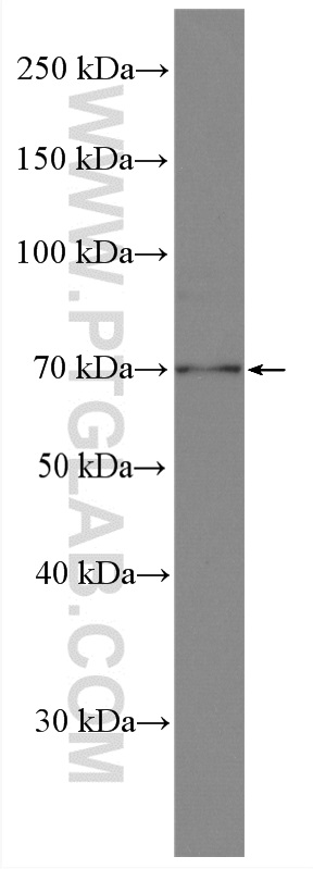 ZC3H14