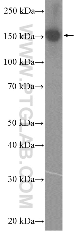 WB analysis of HepG2 using 25807-1-AP