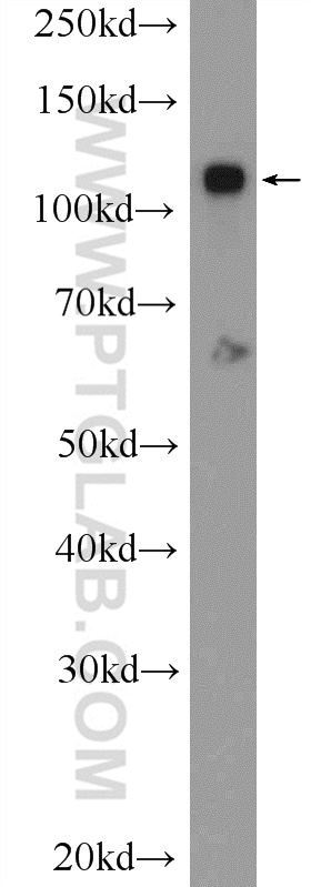 WB analysis of HUVEC using 25624-1-AP