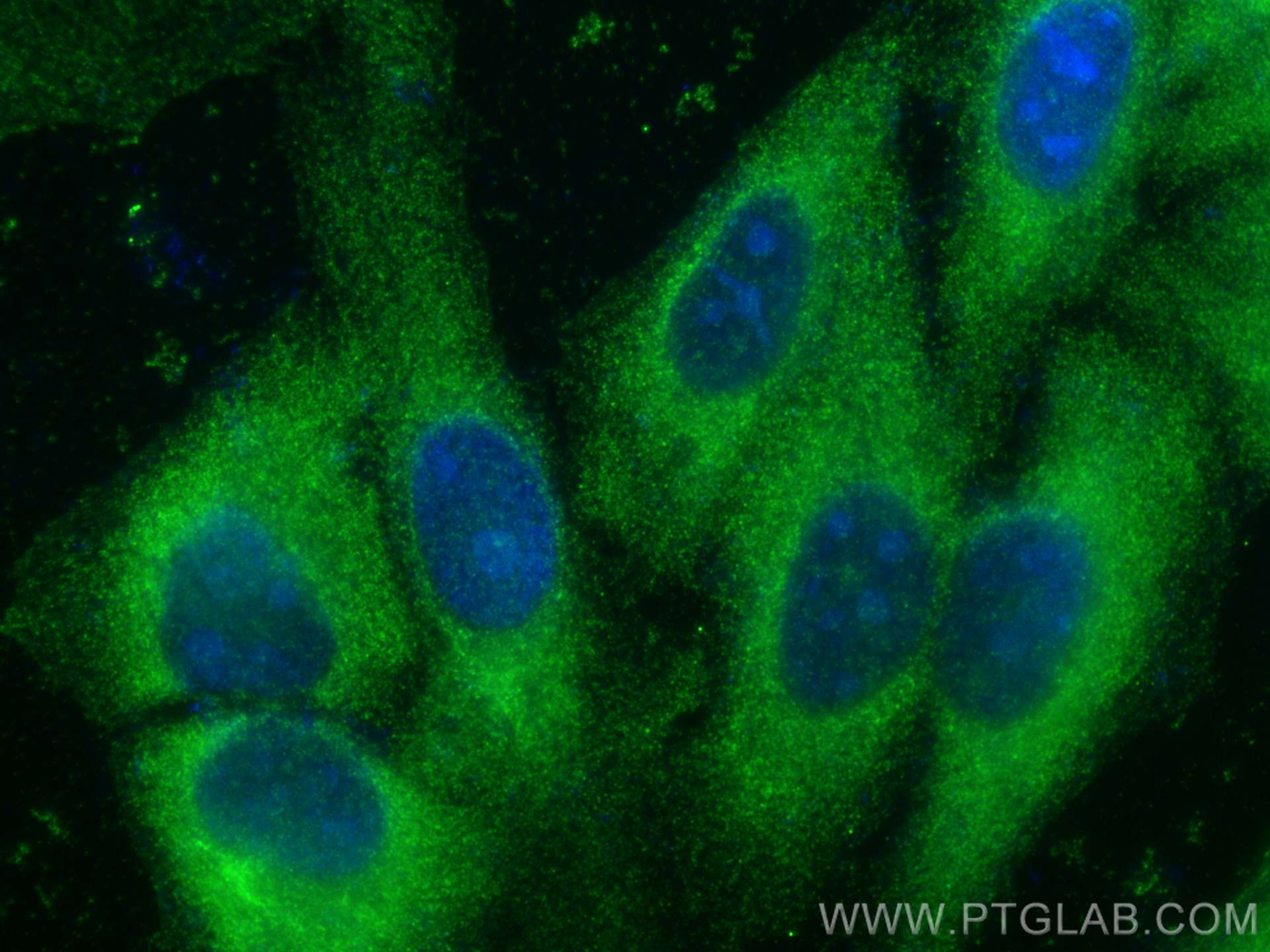 IF Staining of HepG2 using 66413-1-Ig (same clone as 66413-1-PBS)