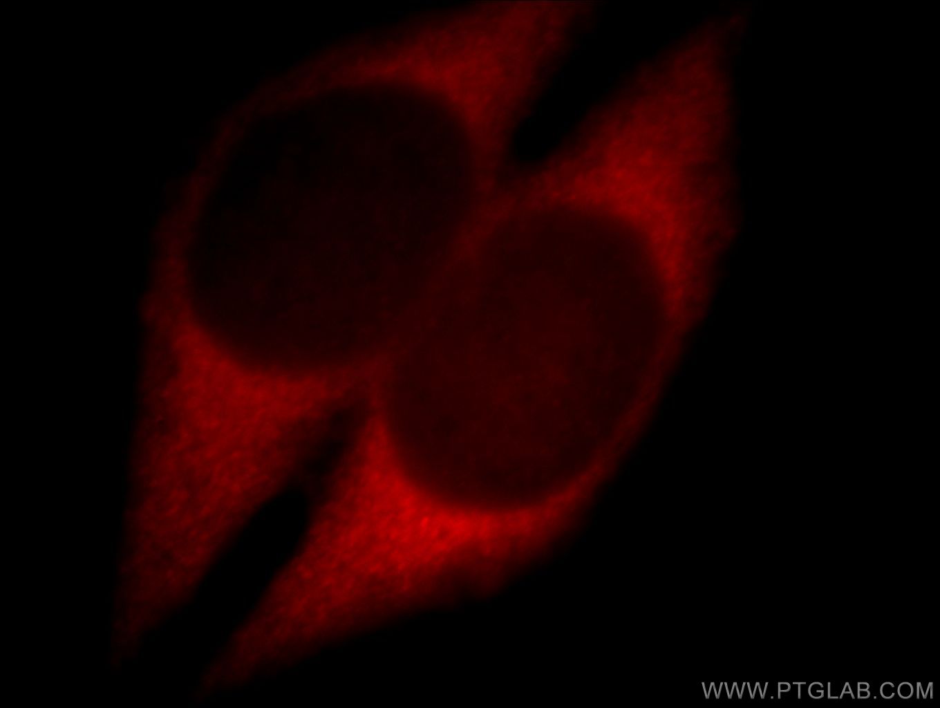 IF Staining of HeLa using 20119-1-AP