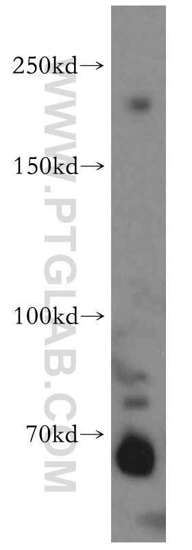 WB analysis of HeLa using 20119-1-AP