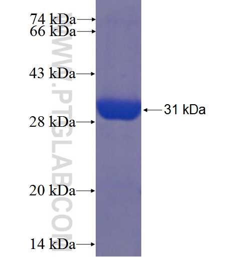 ZCCHC2 fusion protein Ag22744 SDS-PAGE