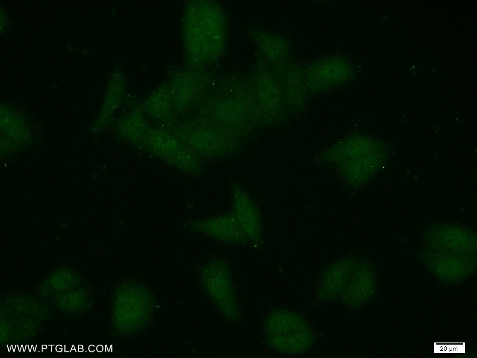 IF Staining of HepG2 using 25629-1-AP