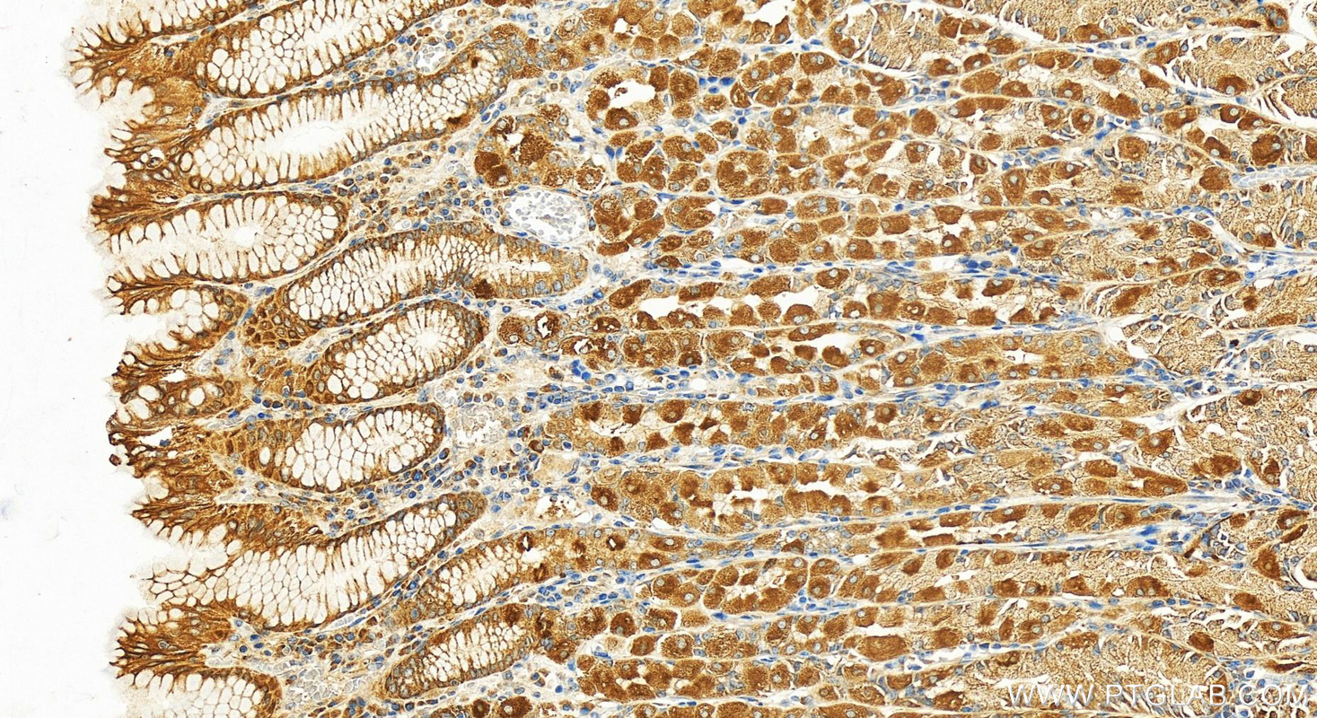 IHC staining of human stomach using 24759-1-AP