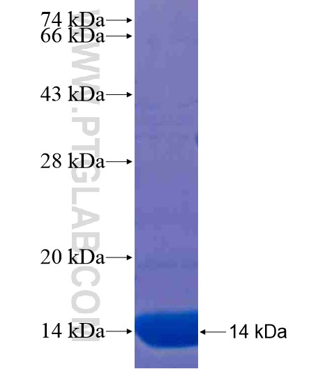 ZDHHC2 fusion protein Ag20510 SDS-PAGE