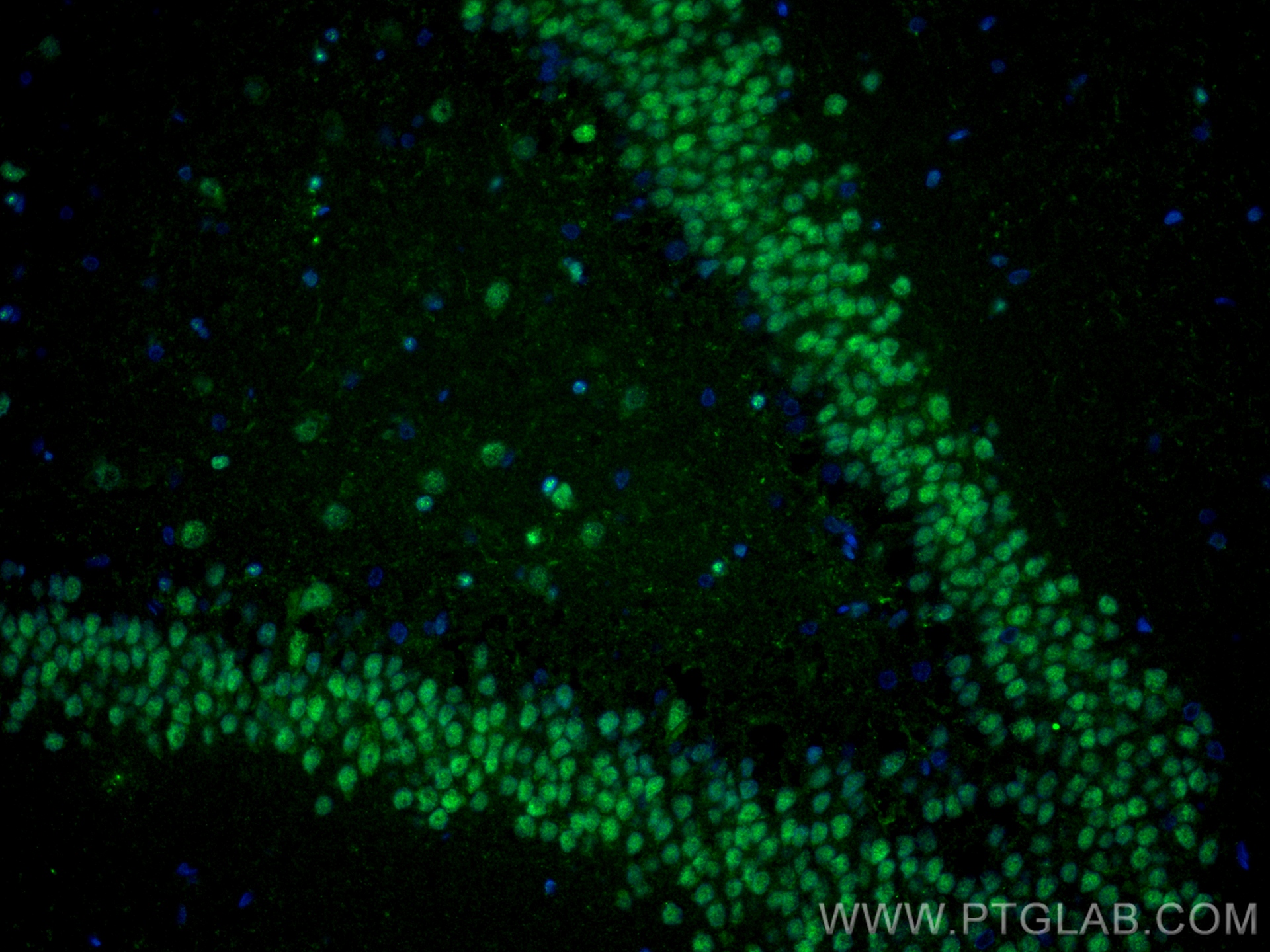 IF Staining of rat brain using 82020-1-RR