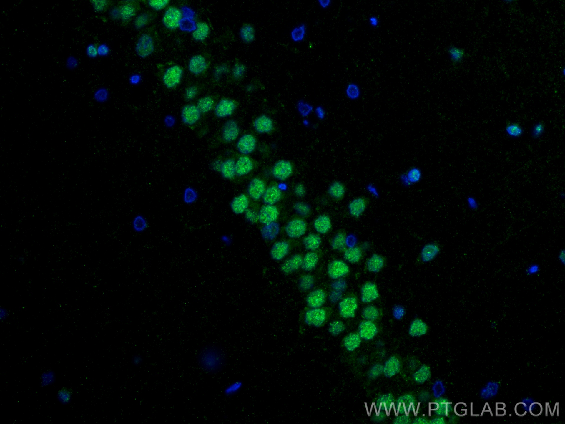 IF Staining of rat brain using 82020-1-RR