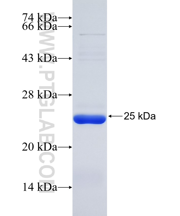 ZEB2 fusion protein Ag27475 SDS-PAGE