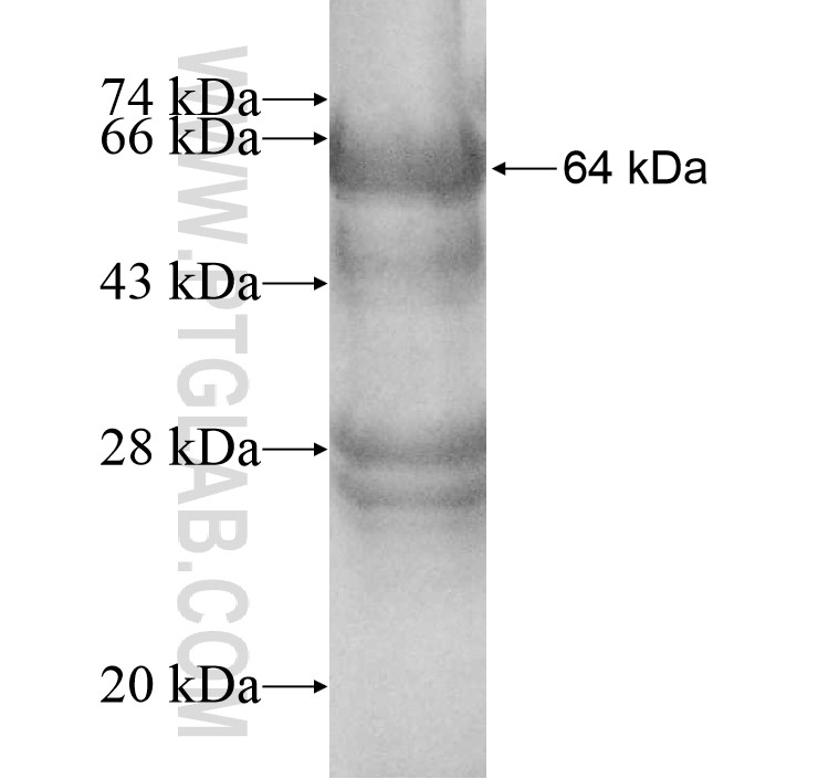 ZFP28 fusion protein Ag10983 SDS-PAGE