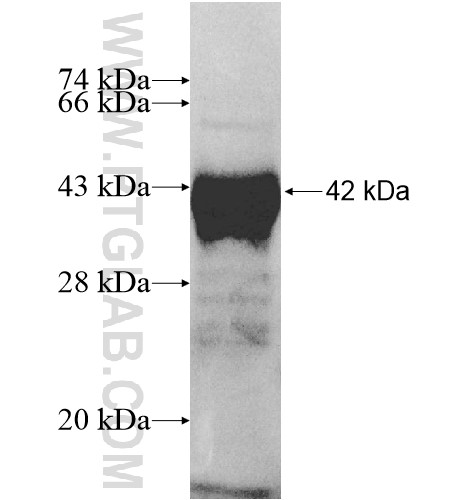 ZFP28 fusion protein Ag11545 SDS-PAGE