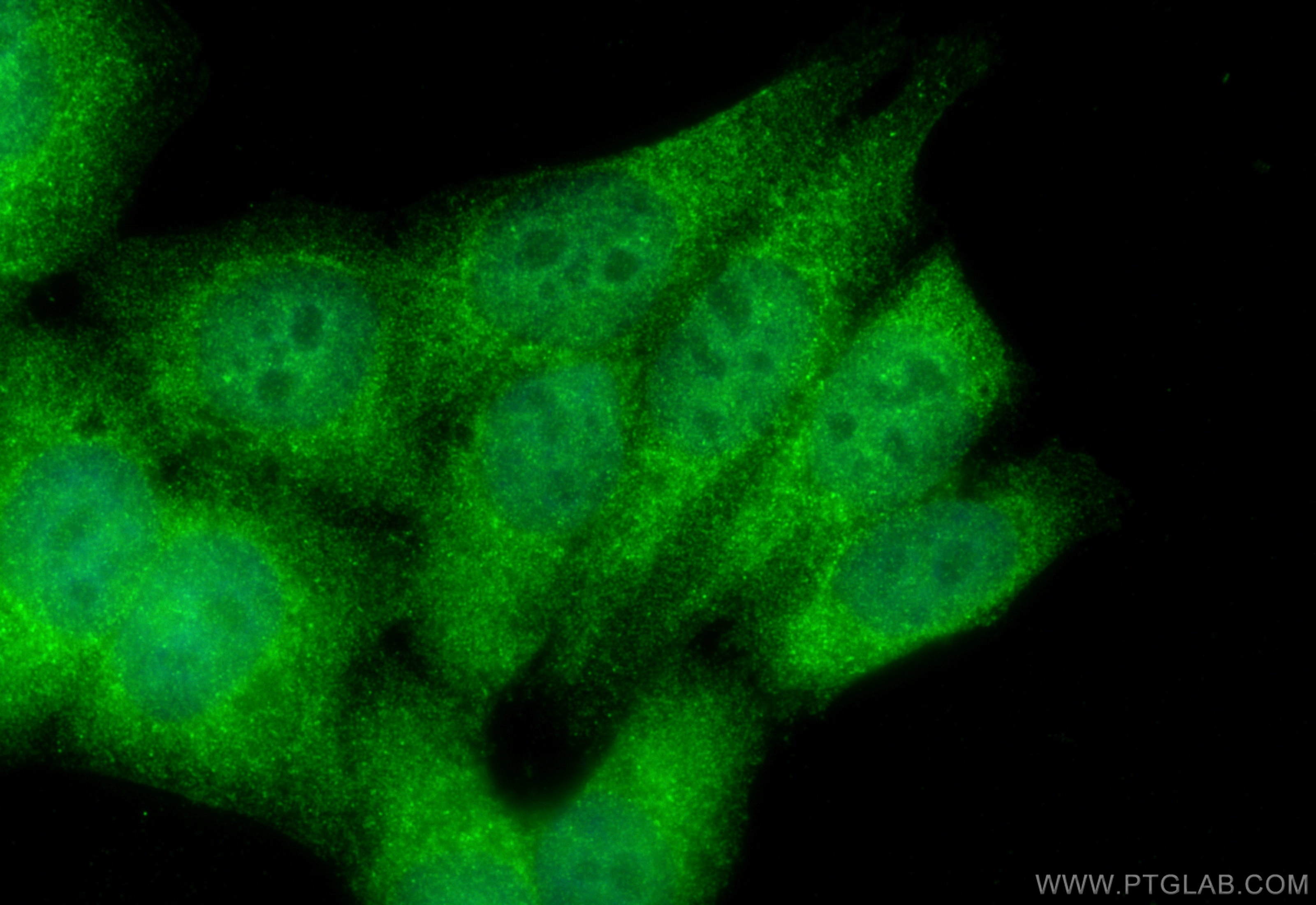 IF Staining of HepG2 using 12737-1-AP