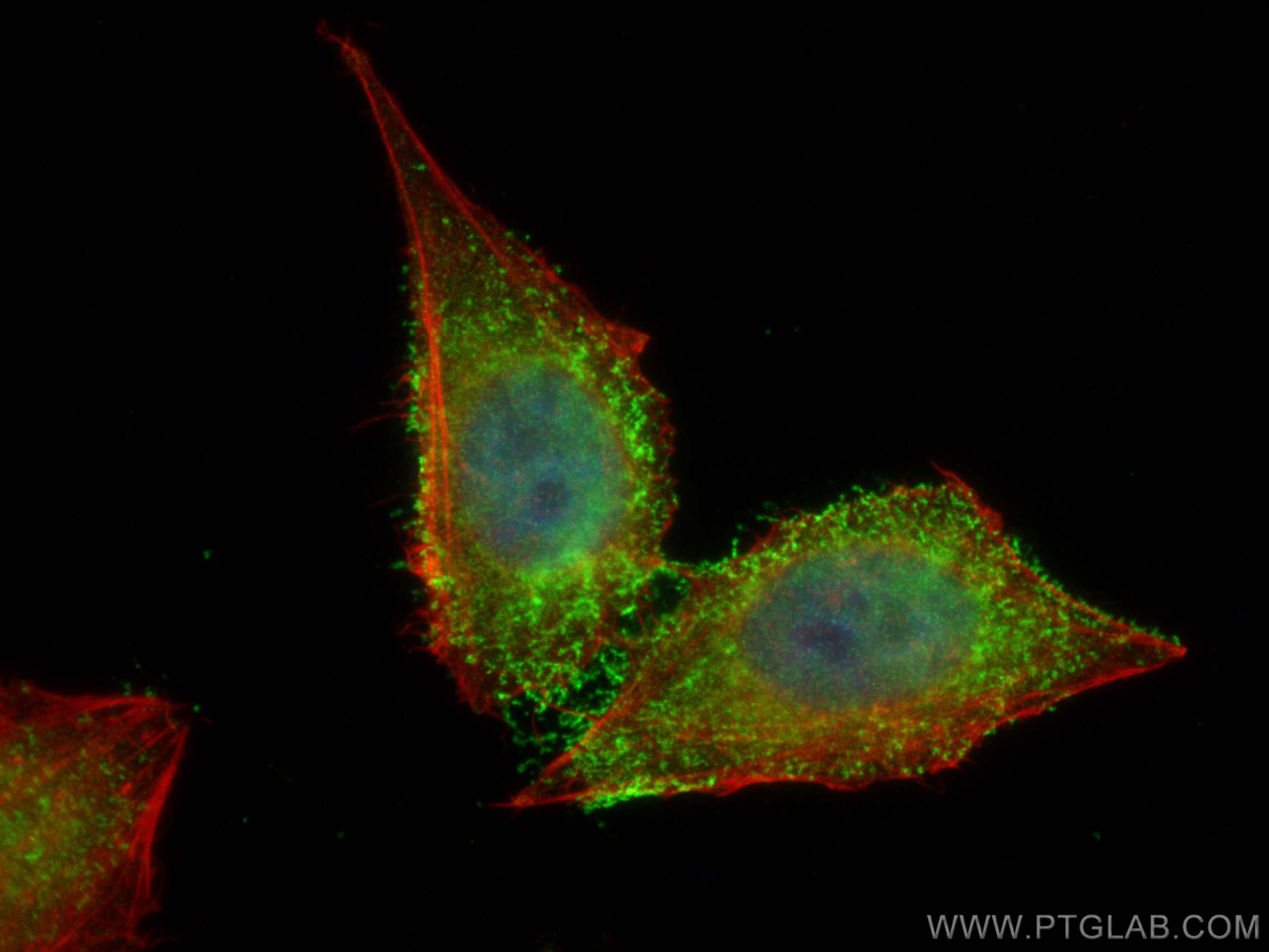 IF Staining of HepG2 using 12306-1-AP